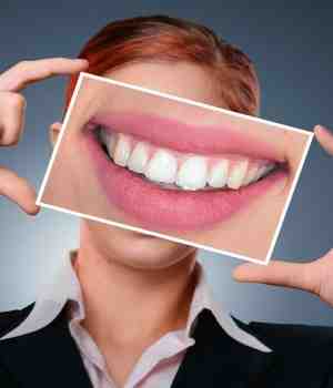 સફેદ દાંત: તંદુરસ્તીની નિશાની?